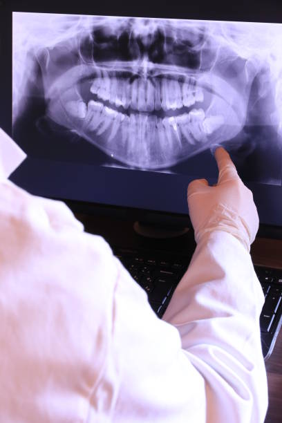 Best Emergency Tooth Extraction in Algood, TN