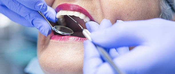 Best Emergency Treatment for Toothache in Algood, TN
